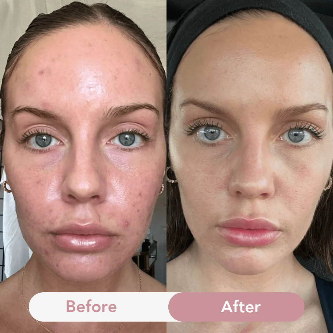 Anti-Aging Collagen Jelly Cream - Image 10