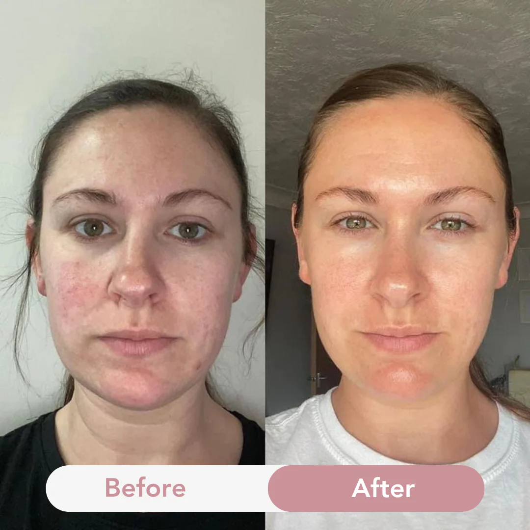Anti-Aging Collagen Jelly Cream - Image 8