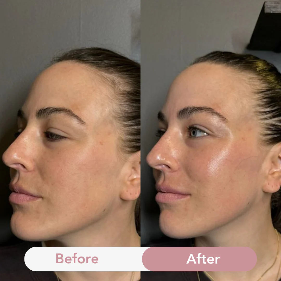 Anti-Aging Collagen Jelly Cream - Image 9