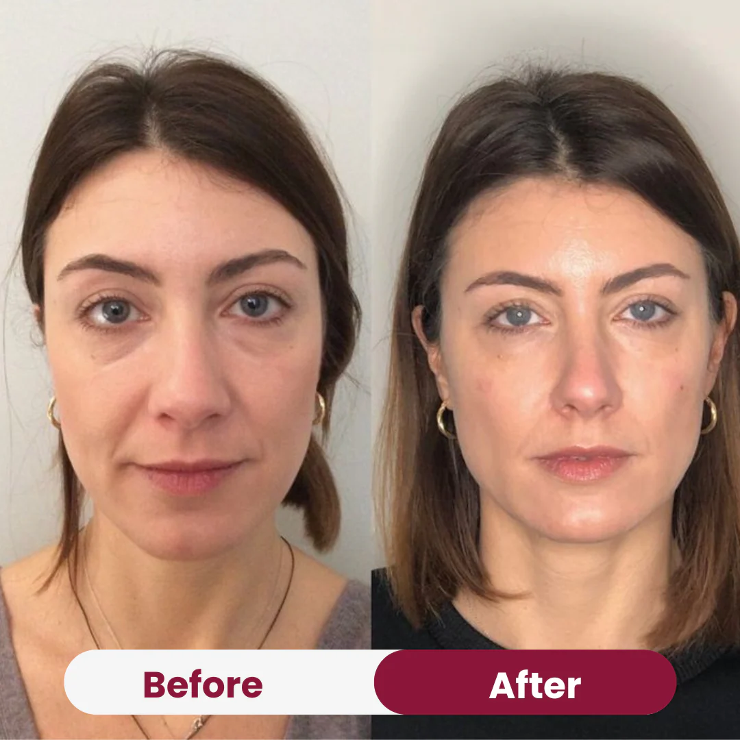 Anti-Wrinkle Sample Sachet - Image 8