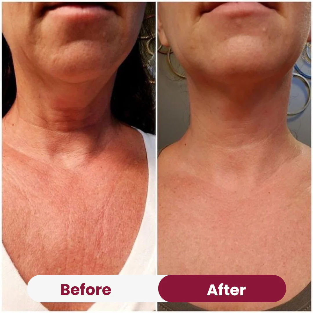 Chest Anti-Wrinkle Patch - Image 6