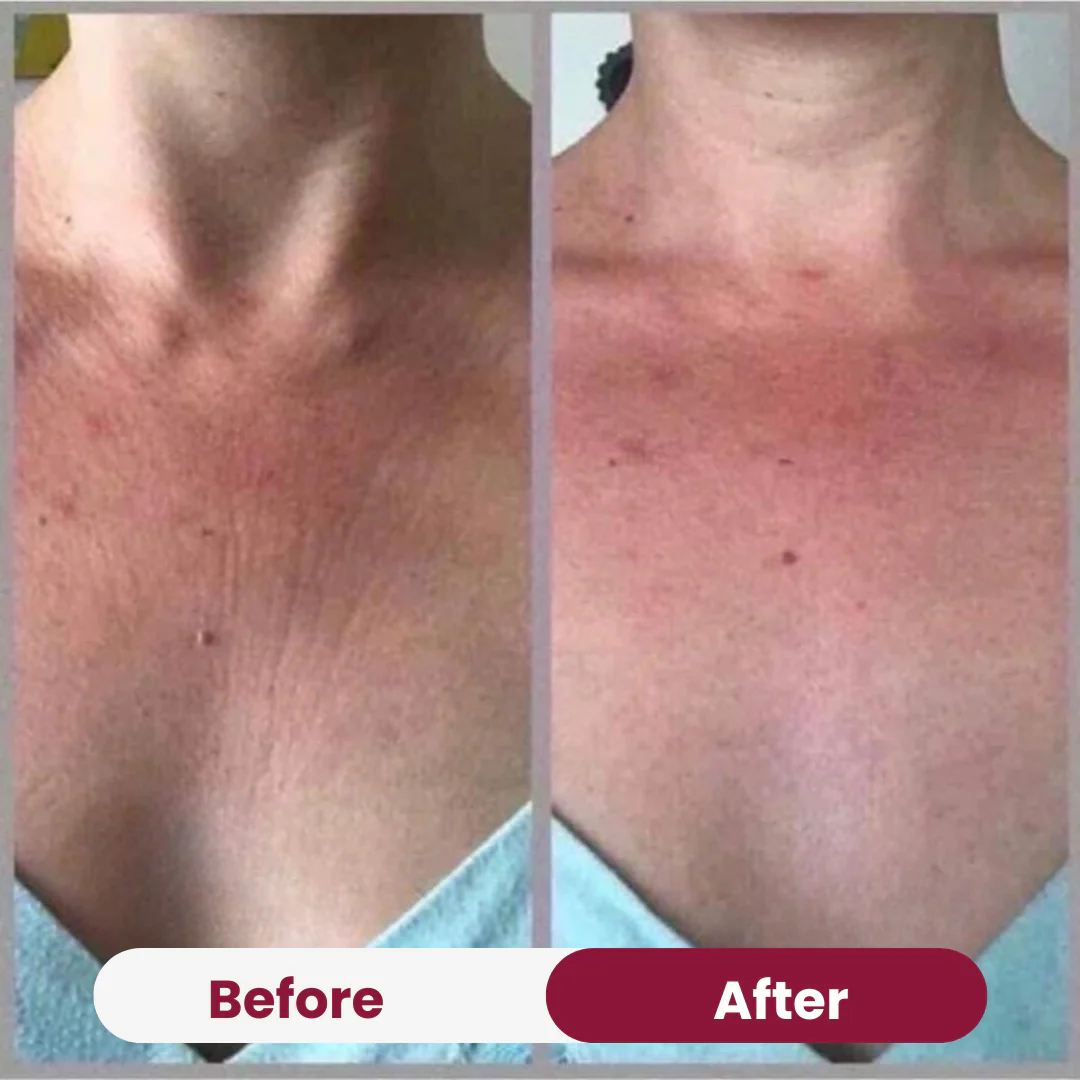 Chest Anti-Wrinkle Patch - Image 7