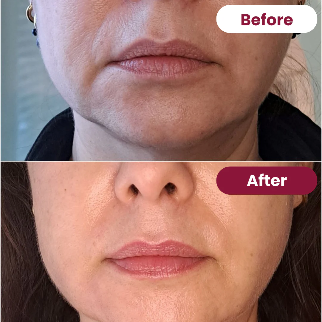 Collagen Mouth Tape - Image 6