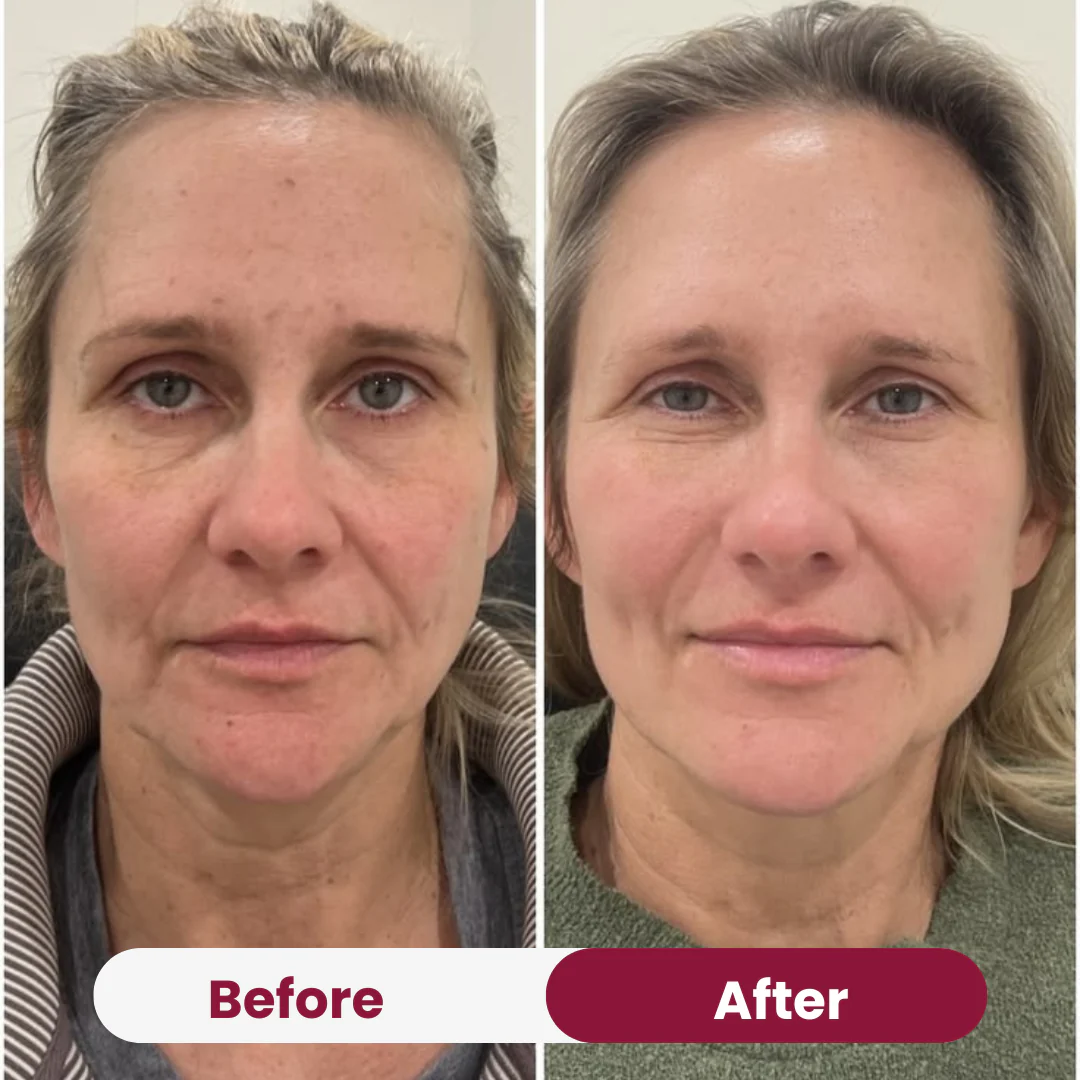 Collagen Peptide Moisturizer - Image 8
