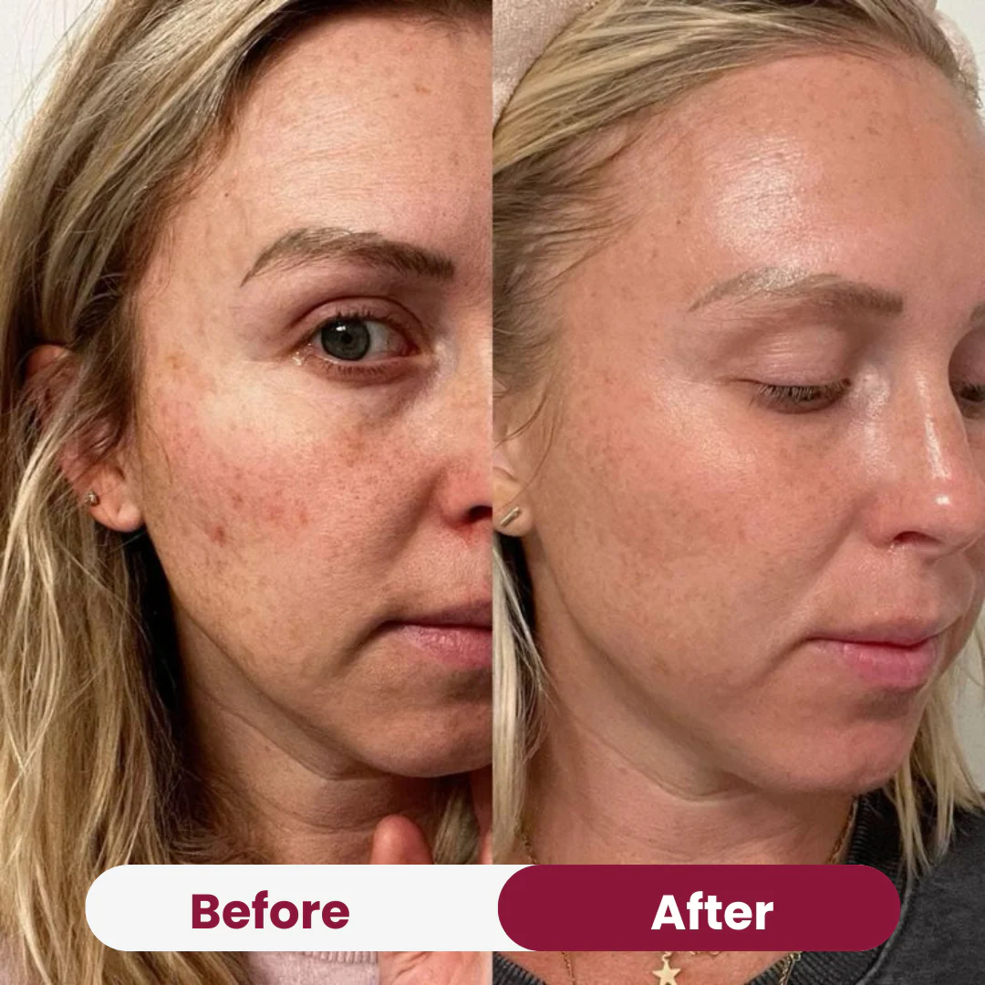 Collagen Peptide Moisturizer - Image 9