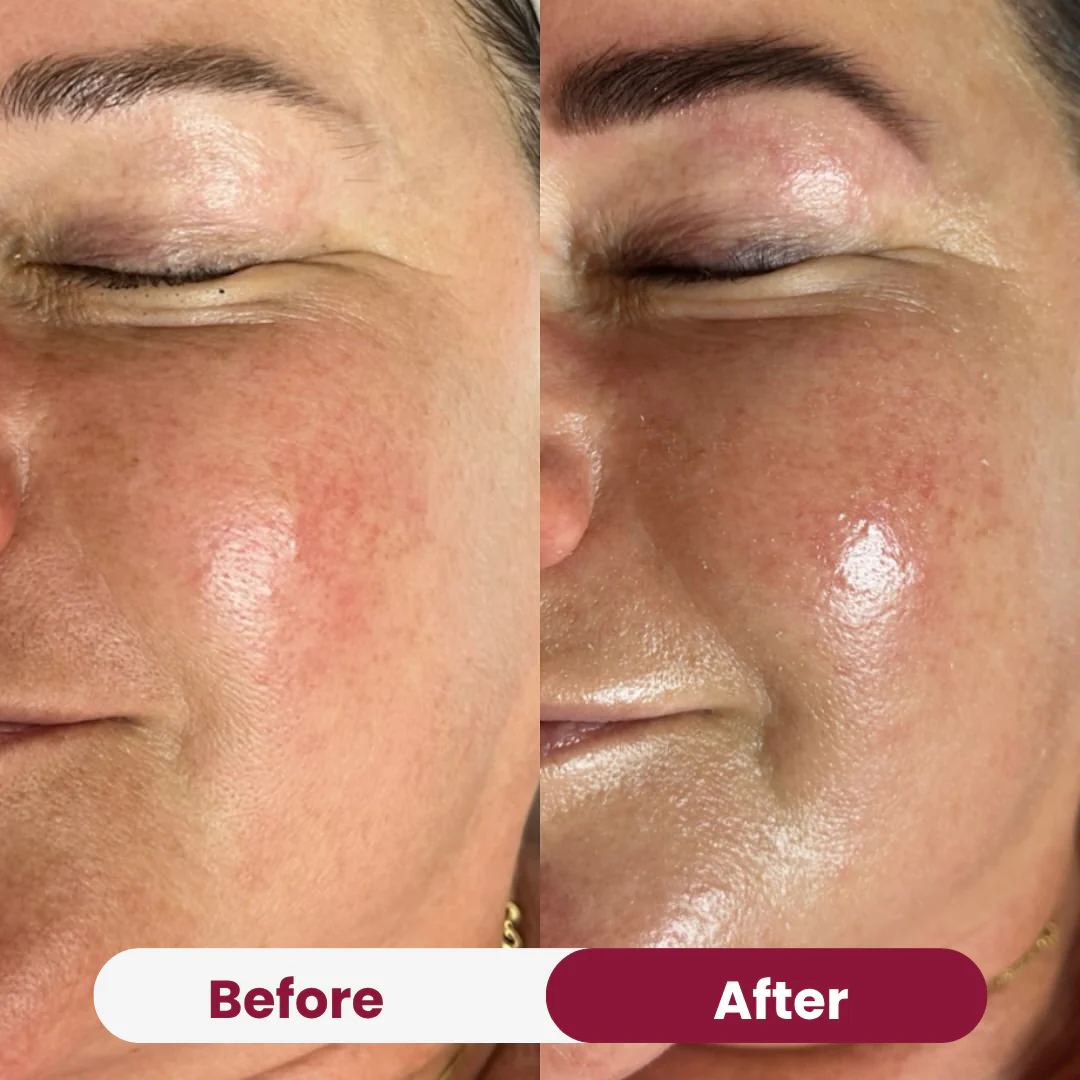 Collagen Wrapping Mask - Image 8