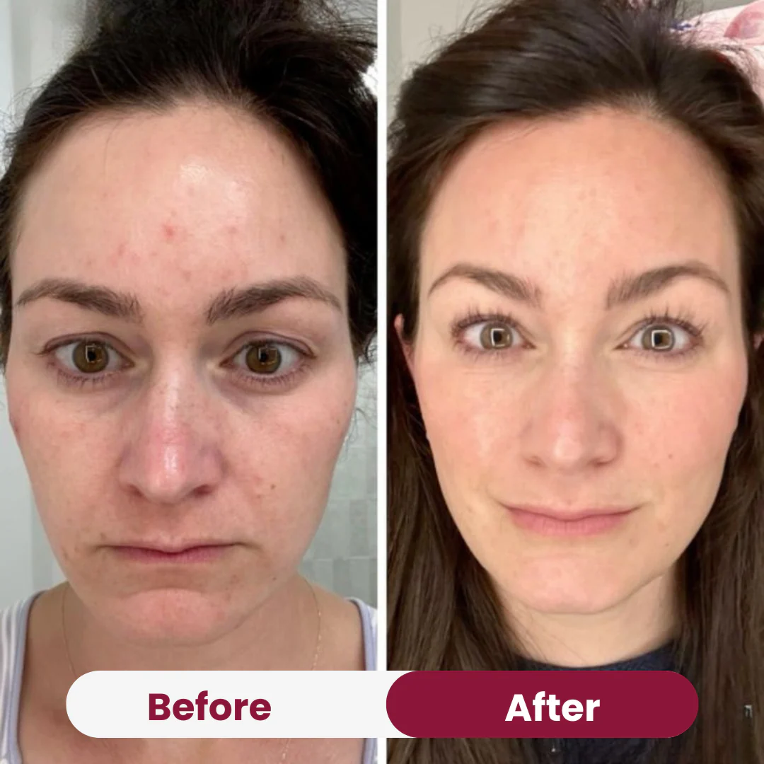 Hydrate & Glow Duo - Image 4
