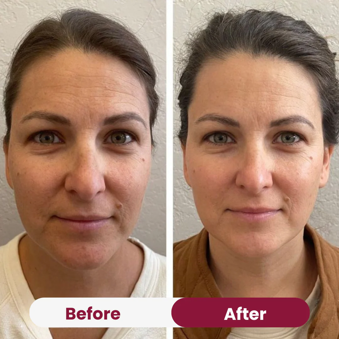 Hydro Cera-Nol Collagen Mask - Image 7