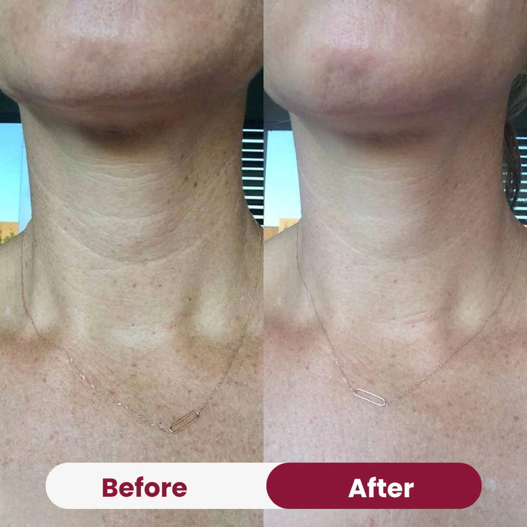 Neck Anti-Wrinkle Patch - Image 7