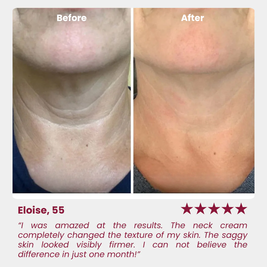 Neck Tightening Cream - Image 2