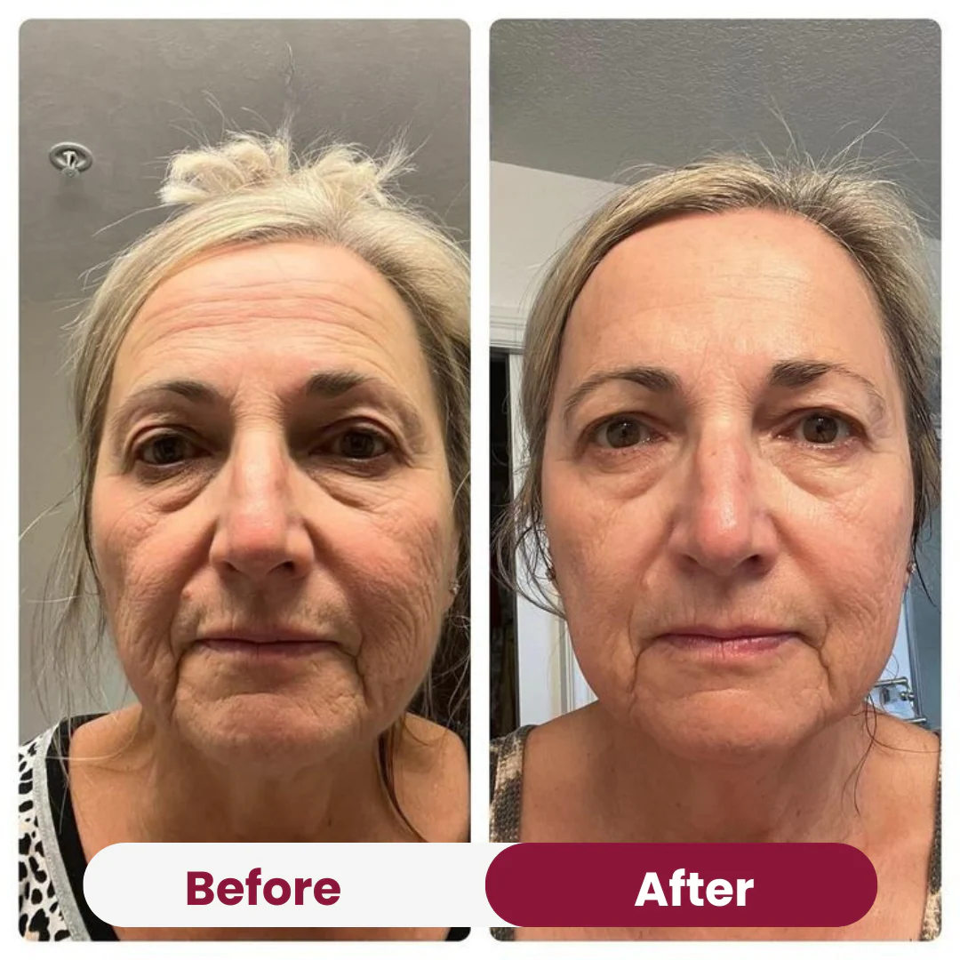 Salmon PDRN Collagen Mask - Image 3