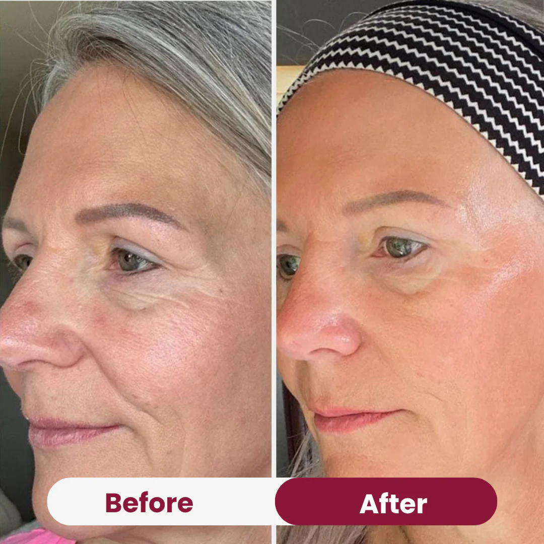Bio-Collagen Mask - Image 5