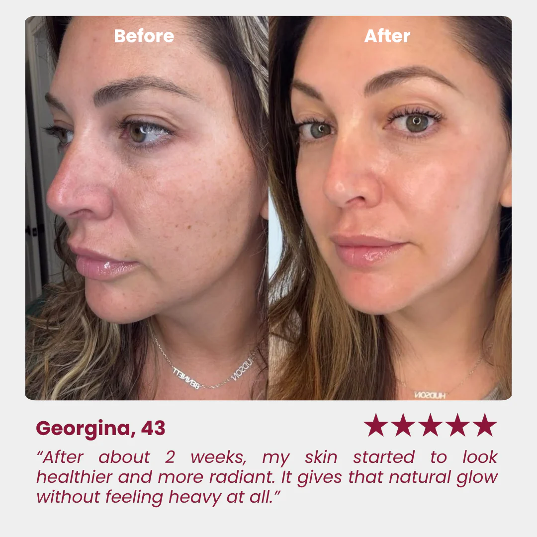 Vitamin C Serum - Image 6
