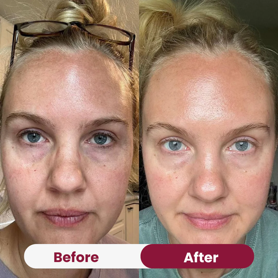 Vitamin C Serum - Image 7