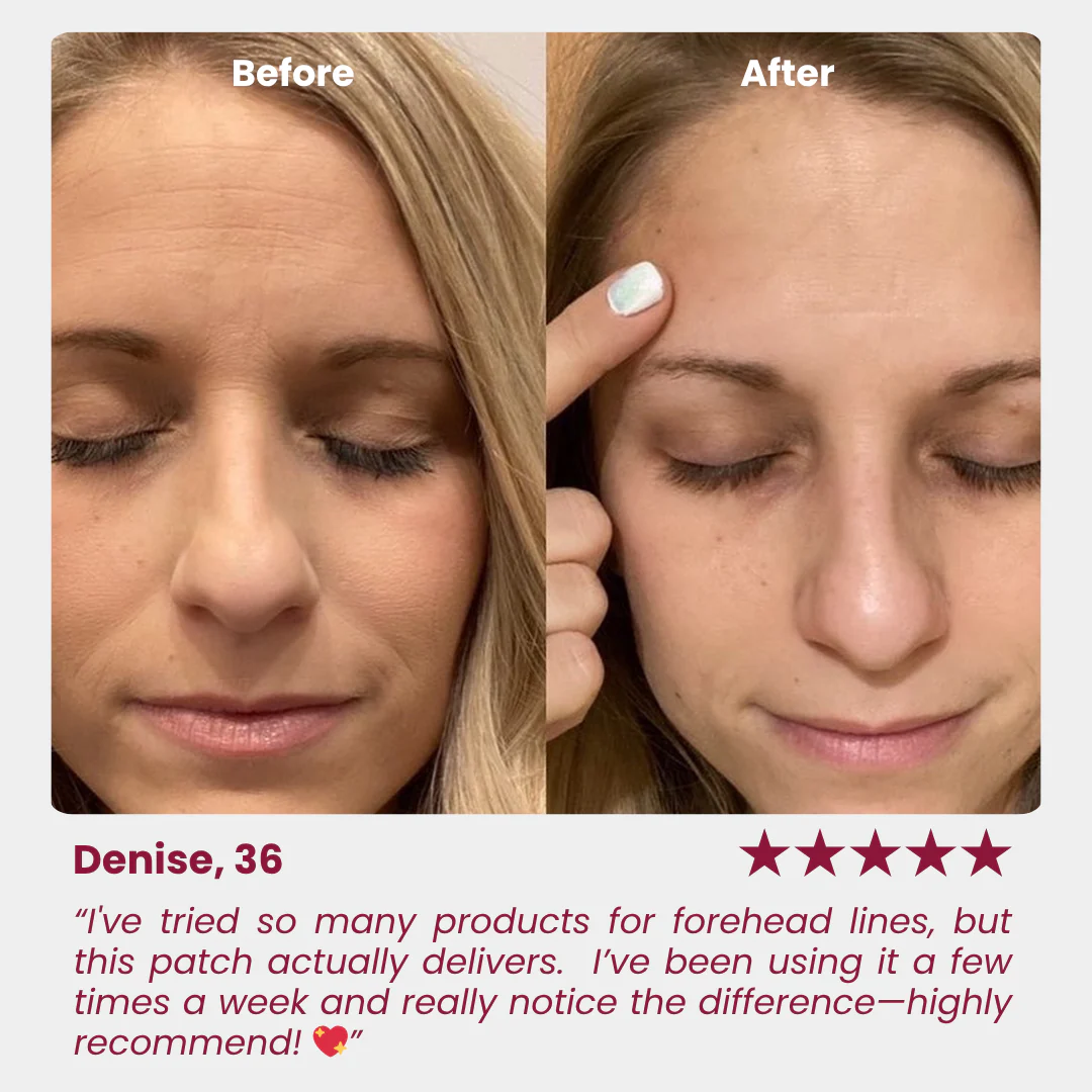 Wrinkle Forehead Patch - Image 4