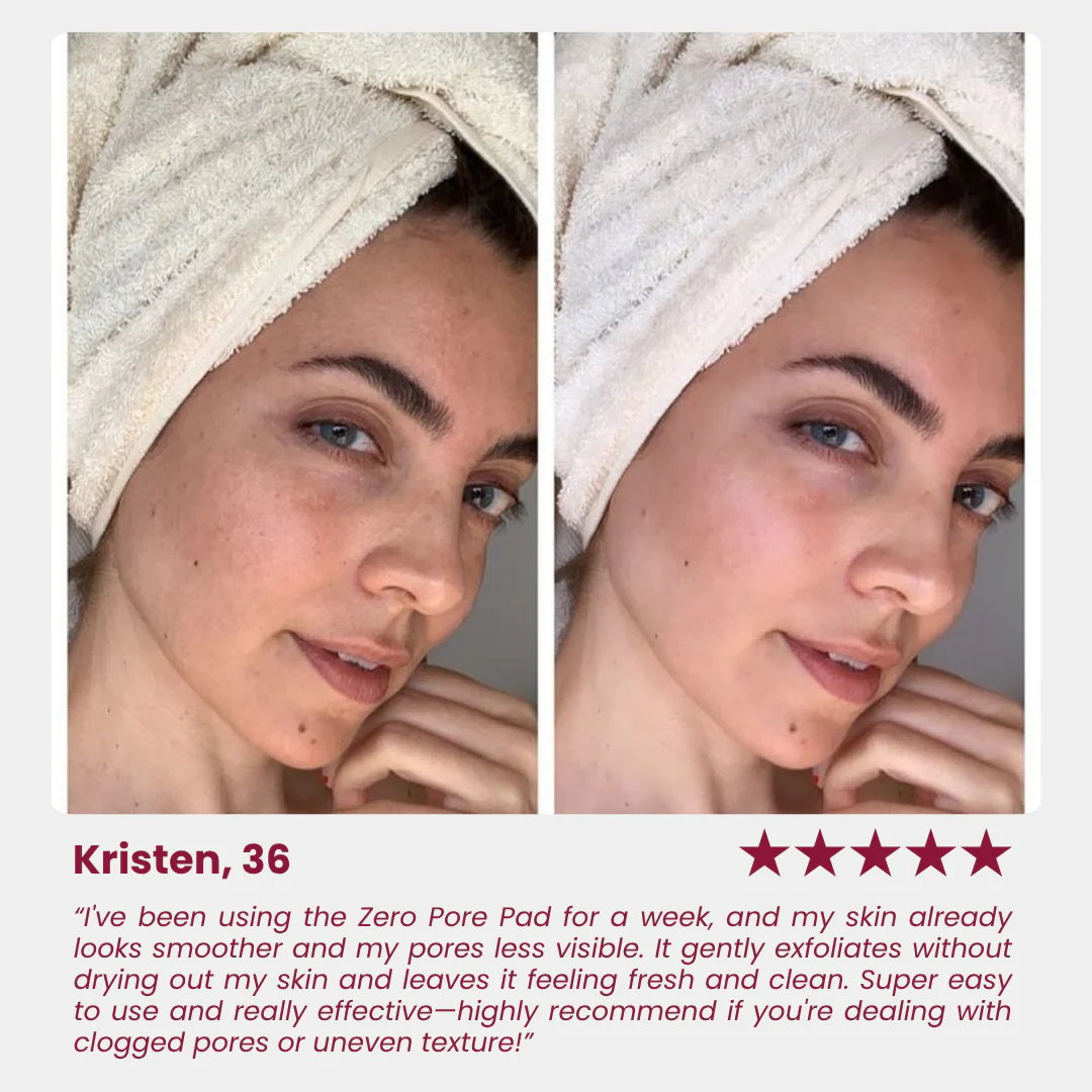 Zero Pore Pad - Image 9